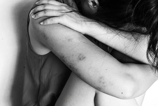 Sexual assault and abuse - domestic violance - Tembusu Law